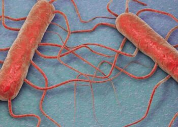 Alerta sanitaria: Retiran productos cárnicos de supermercado por listeria, ¡revisa si tienes alguno en casa!