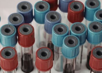 Crece la presión para mejorar el acceso a nuevos anticoagulantes en España y garantizar equidad en el tratamiento