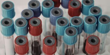 Crece la presión para mejorar el acceso a nuevos anticoagulantes en España y garantizar equidad en el tratamiento