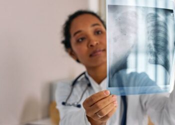 El cáncer de pulmón se dispara entre personas más jóvenes: hasta un 5 % de los nuevos casos se diagnostica antes de los 50 años