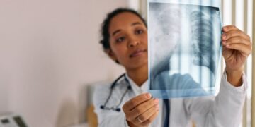 El cáncer de pulmón se dispara entre personas más jóvenes: hasta un 5 % de los nuevos casos se diagnostica antes de los 50 años