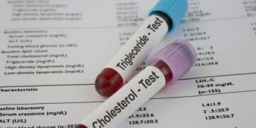 Esta pastilla reduce el colesterol malo en casi un 60%: una nueva esperanza para quienes sufren hipercolesterolemia familiar