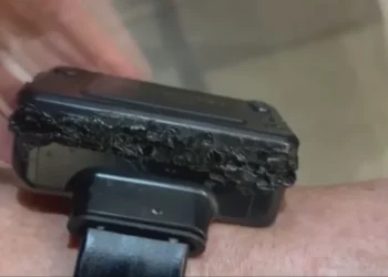 Bolsonaro justifica la manipulación de su tobillera como efecto de “una alucinación”provocada por fármacos