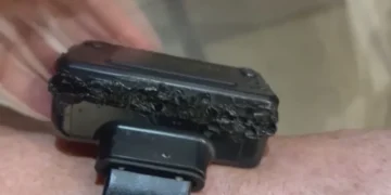 Bolsonaro justifica la manipulación de su tobillera como efecto de “una alucinación”provocada por fármacos