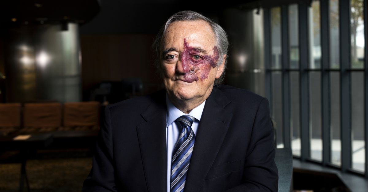 Mariano Barbacid tratamiento cáncer páncreas