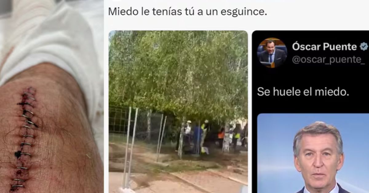 El PP arranca la precampaña electoral mofándose de una lesión del ministro Óscar Puente El PP arranca la precampaña electoral mofándose de una lesión del ministro Óscar Puente